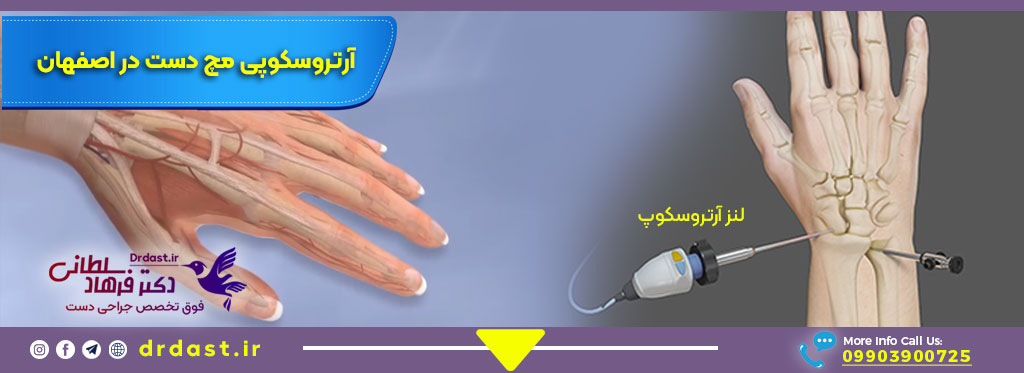 آرتروسکوپی-مچ-دست-در-اصفهان-فوق-تخصص-جراحی-مچ-دست-دکتر-خوب-برای-جراحی-مچ-دست