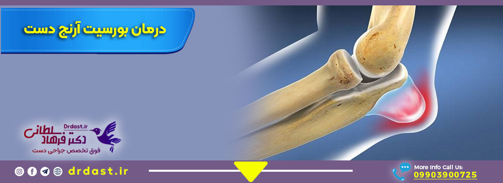 درمان-بورسیت-آرنج-دست-فوق-تخصص-جراحی-دست-جراح-ارنج-در-اصفهان